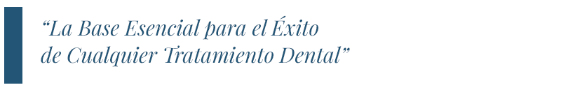 Periodoncia en Marbella