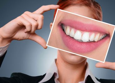 Avances en carillas dentales: nuevos composites y cerámicas