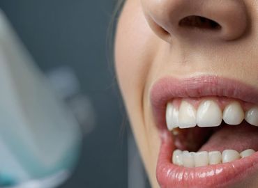 Una silenciosa enfermedad se propaga afectando la salud bucal de jóvenes