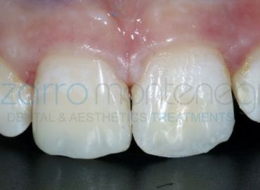 Estética dental para todos